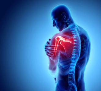 Боль и дискомфорт в плечевом суставе